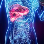 Understanding Liver Disease: What It Is and Why It Matters