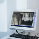 Radiology and Radiography: Understanding Their Importance in Healthcare