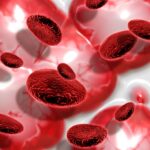 Iron Deficiency Anaemia: Diagnosis and Treatment Explained